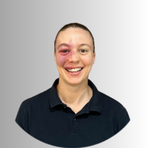 Lucie Myers - Bolton Based member of our Neurological Physiotherapy Team in the NorthWest